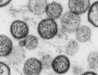 Hantavirus. // Source : Institut Pasteur Hantavirus. // Source : Institut Pasteur