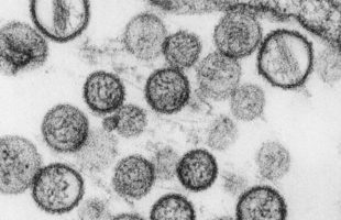 Hantavirus. // Source : Institut Pasteur