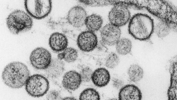 Hantavirus. // Source : Institut Pasteur