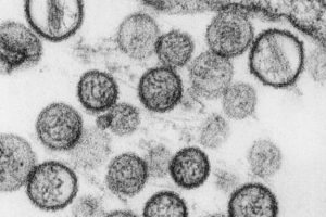 Hantavirus. // Source : Institut Pasteur Hantavirus. // Source : Institut Pasteur