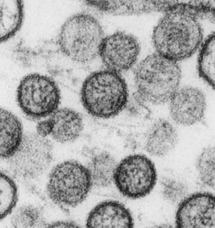Hantavirus. // Source : Institut Pasteur Hantavirus. // Source : Institut Pasteur