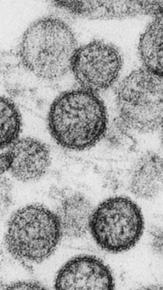 Hantavirus. // Source : Institut Pasteur Hantavirus. // Source : Institut Pasteur