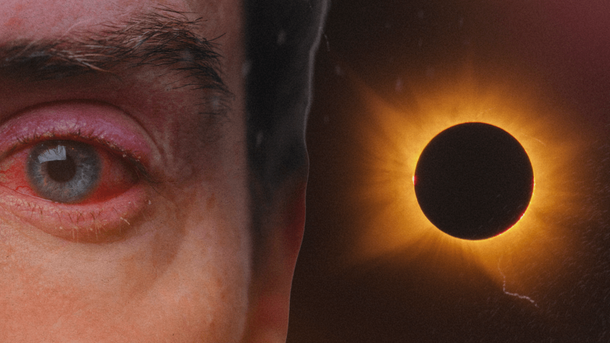 Vous avez mal aux yeux après l’éclipse ? La douleur n’est pas forcément le symptôme le plus inquiétant // Source : Numerama / NASA Vous avez mal aux yeux après l’éclipse ? La douleur n’est pas forcément le symptôme le plus inquiétant // Source : Numerama / NASA